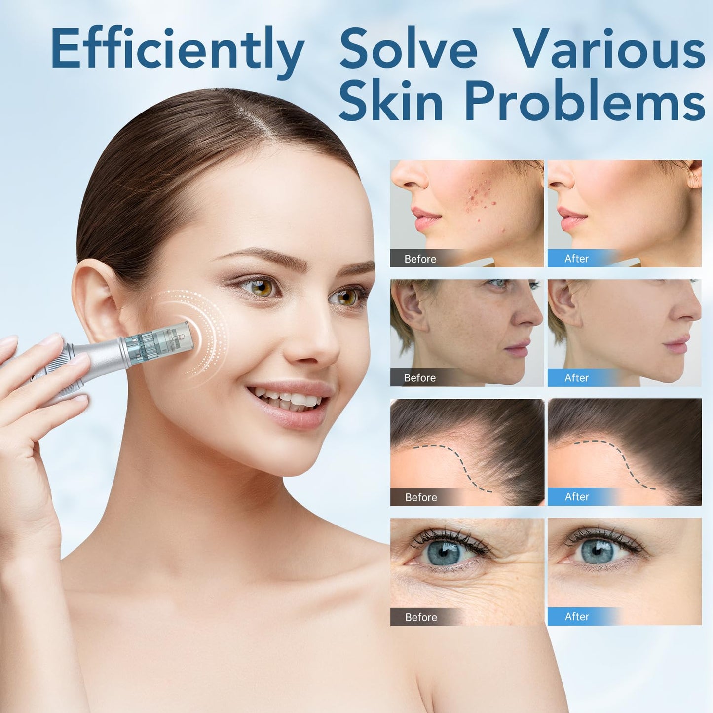 Dr. pen Ultima M7S Microneedling Pen