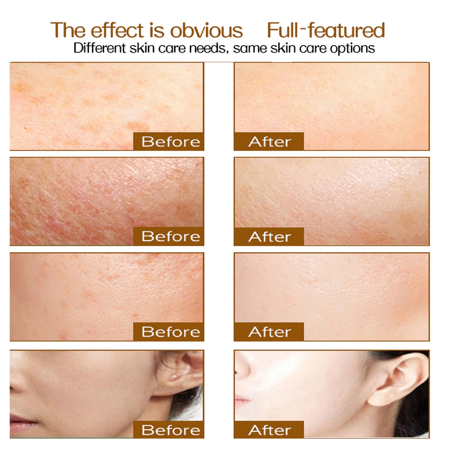 Derma Roller 192 Titanium 1.0mm Microneedling Roller