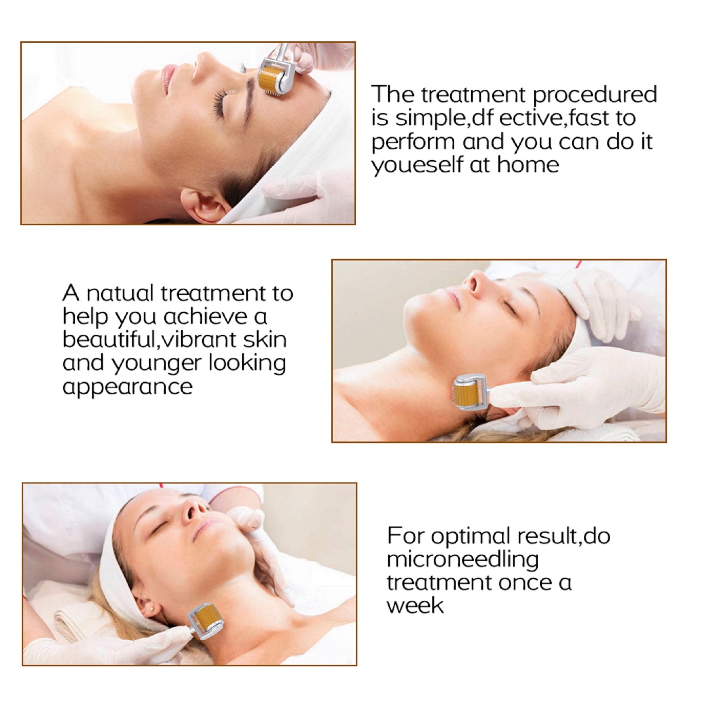 Derma Roller 192 Titanium 1.0mm Microneedling Roller